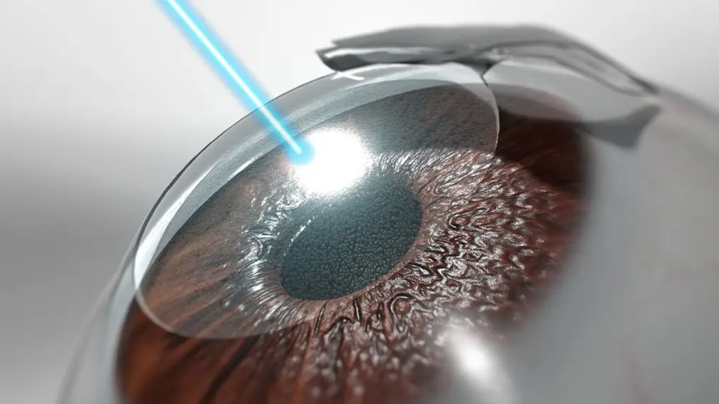 NYC Lasik Near Me – Safe, Advanced Vision Correction Options