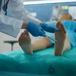 What Signs Indicate You May Need Surgery From a Podiatrist